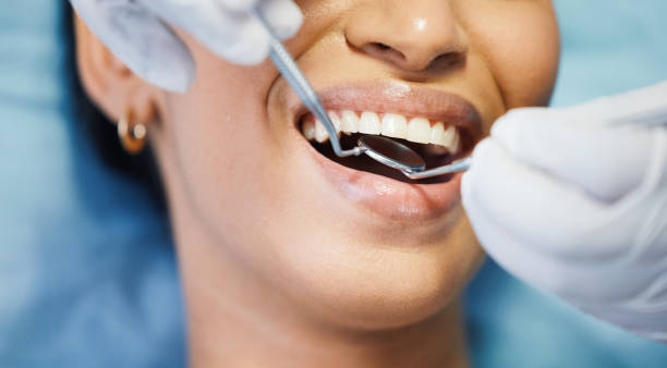 Best Emergency Tooth Extraction in Baudette, MN